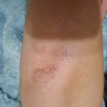 Крем от экземы в Киеве и городах Украины – лучшая цена