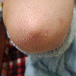 Де купити ефективну мазь від екземи на руках з доставкою по Києву та Україні?