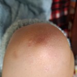 Мазь от псориаза в Киеве и городах Украины  - лучшие цены