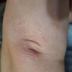 Шампунь от себорейного дерматита в Киеве и городах Украины – цена от производителя