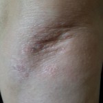 Де купити найкращу мазь від дерматиту у дорослих у Києві та Україні?