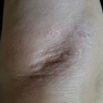 Крем от атопического дерматита в Киеве и городах Украины - цены производителя