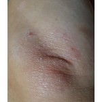 Мазь от псориаза на голове в Киеве и городах Украины - выгодные цены