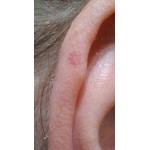 Де купити шампунь від себорейного дерматиту в Києві та Україні з доставкою?