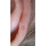 Мази, средства и препараты от псориаза в Киеве и Украине – выгодная цена