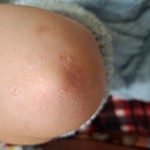 Де купити крем та мазь від бляшкового псоріазу у Хмельницькому та Хмельницькій області