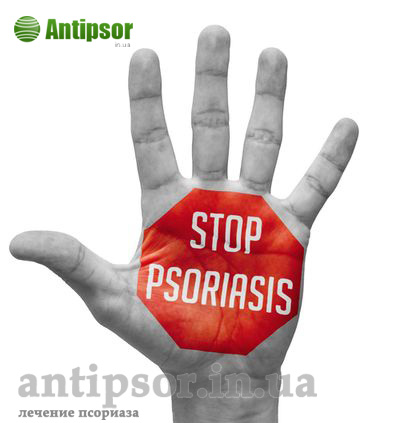 how to protect against psoriasis